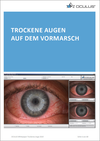 Trockenes Auge - Ursachen und Behandlung - OCULUS Optikgeräte GmbH