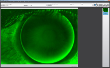 https://www.oculus.de/us/wp-content/uploads/sites/10/2021/09/oculus_keratograph_imagingsoftware_fluobild_aufnahme.jpg