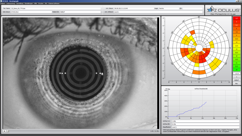 Eye Charts - Vision Test Types - OCULUS Optikgeräte GmbH